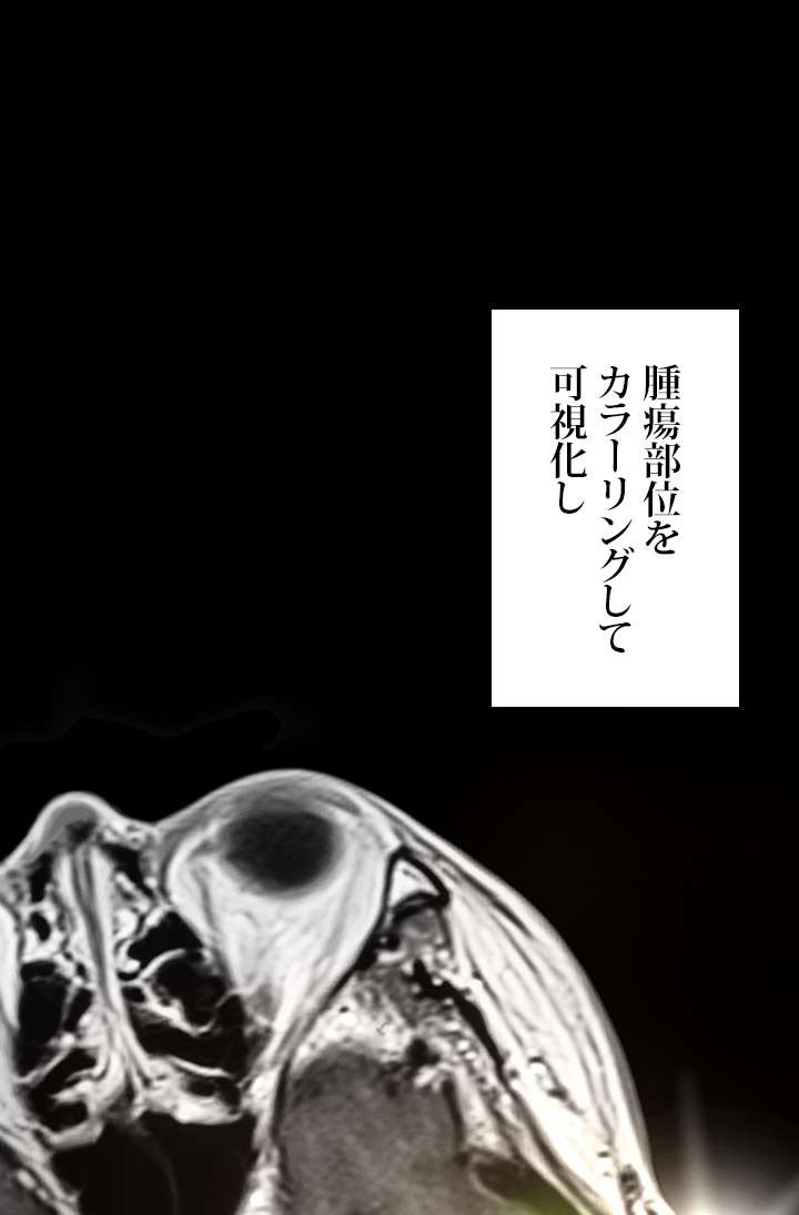 P81