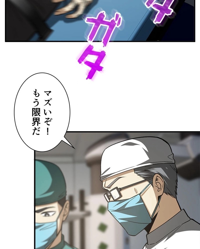 P35