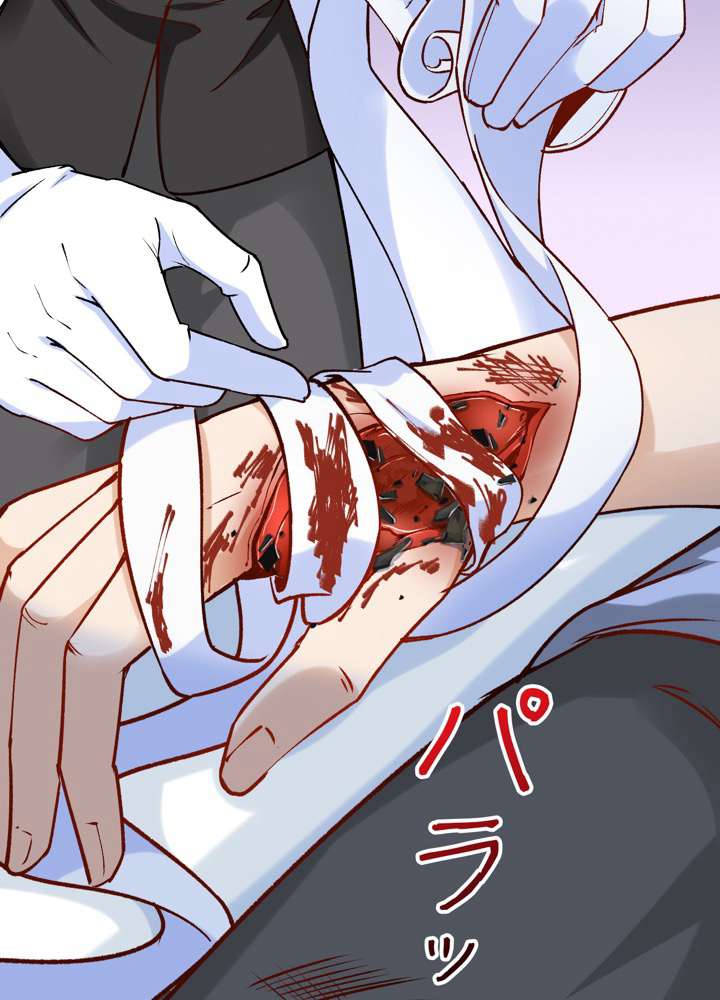 P86