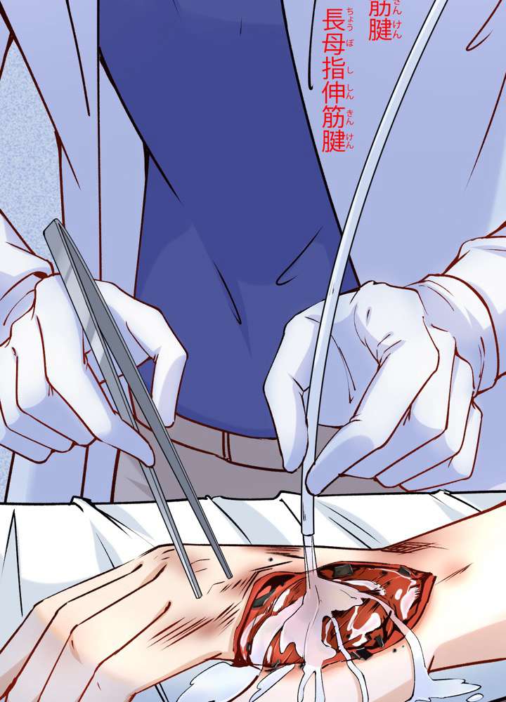 P99