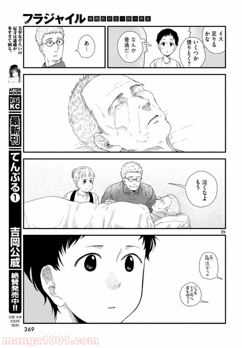 P35