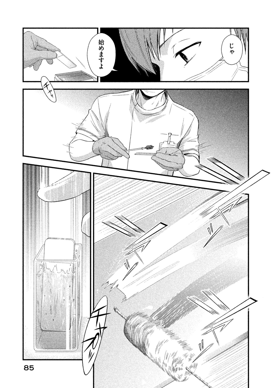P35