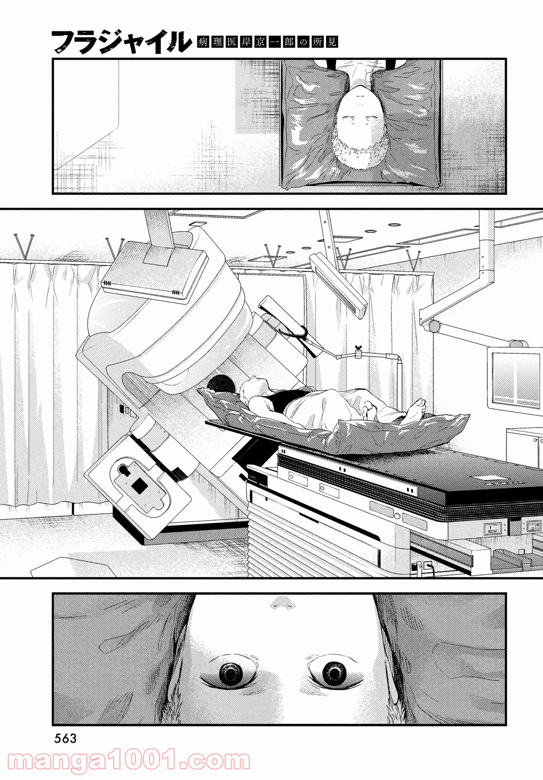 P25