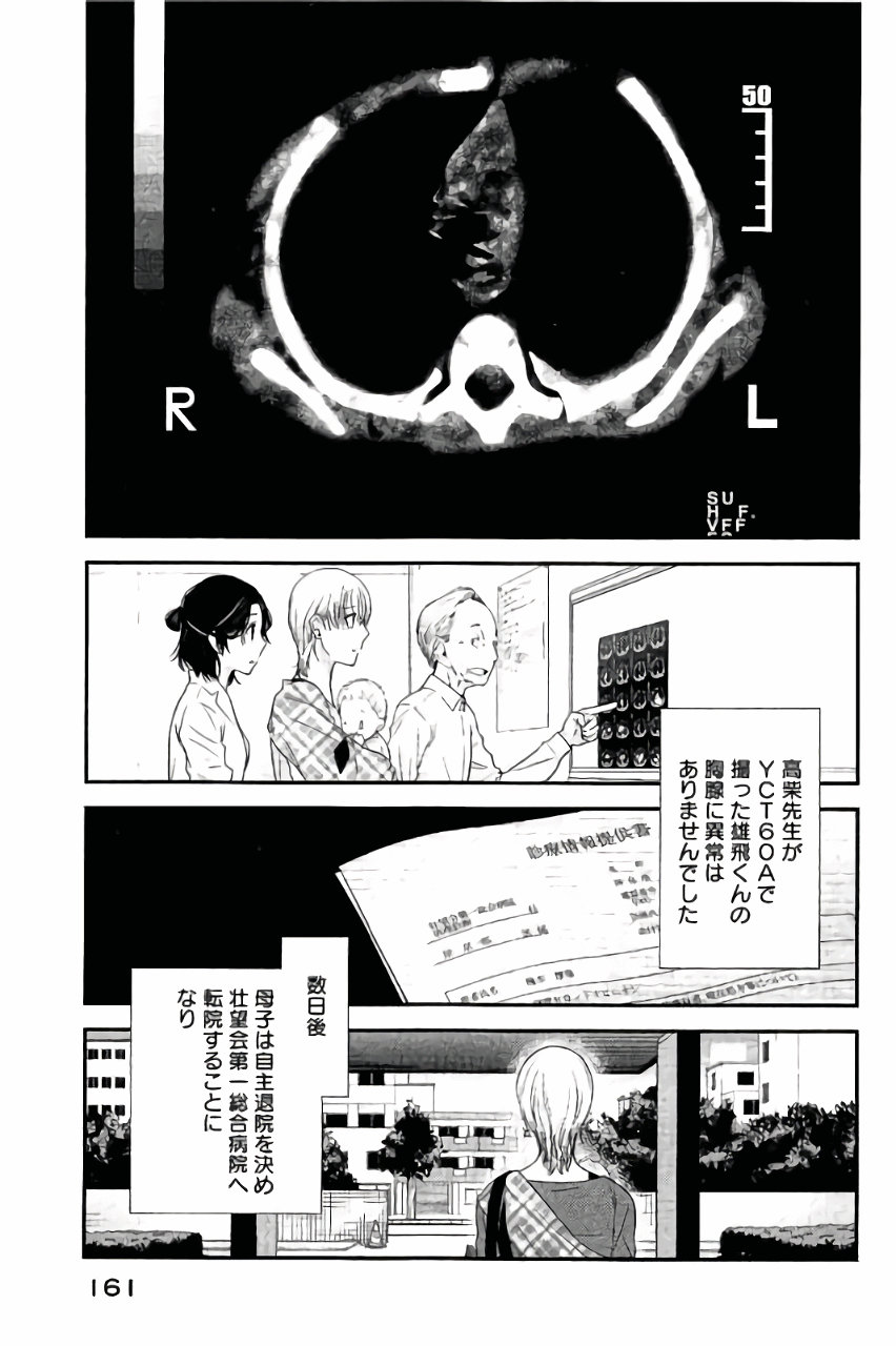 P31