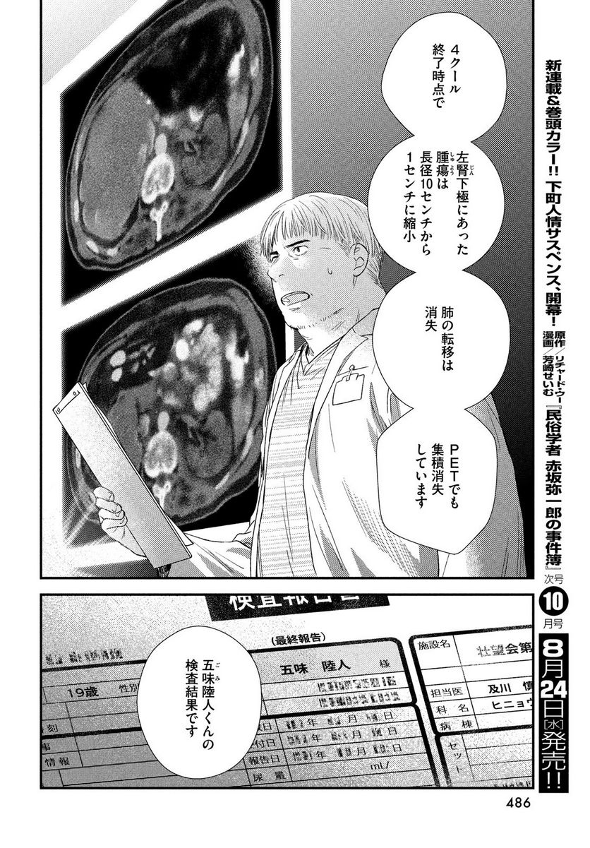 P33