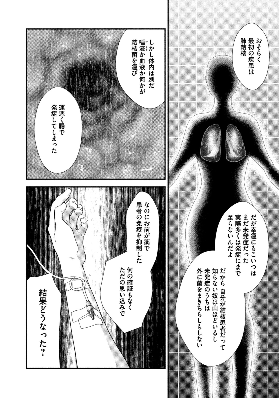 P38