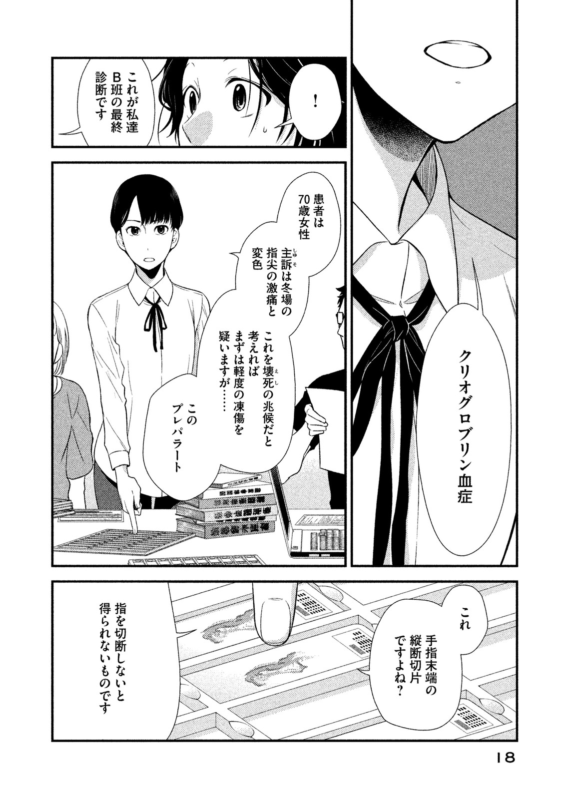 P14