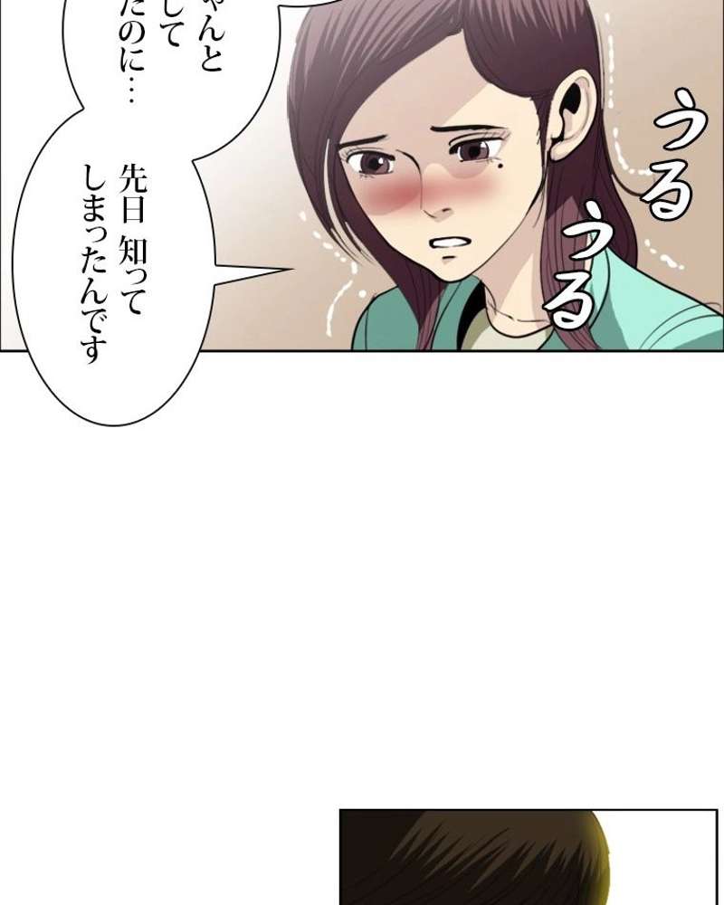P35