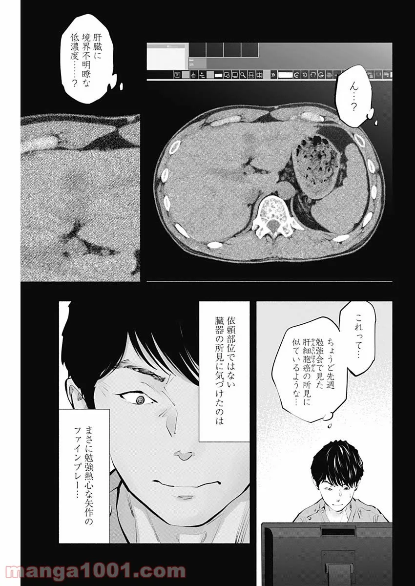 P17