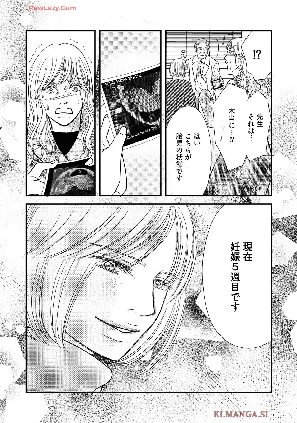 P33