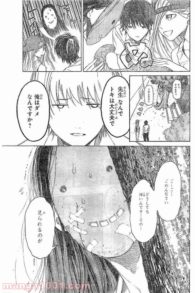 P21