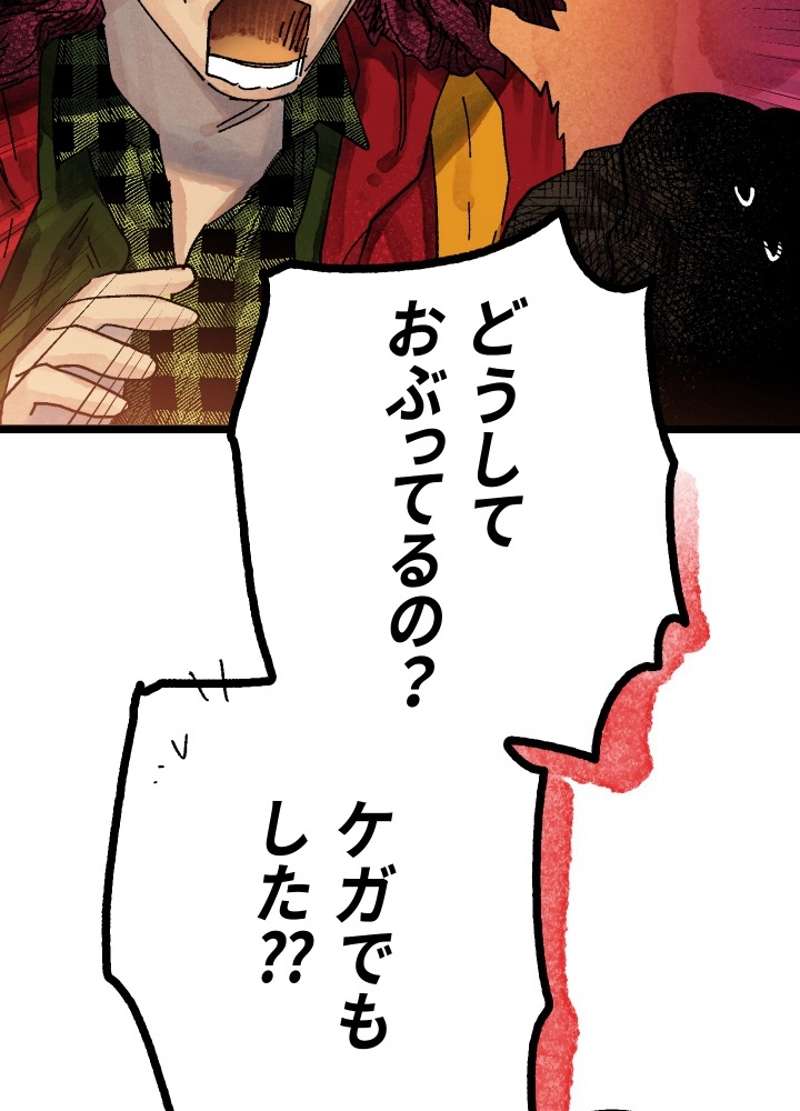 P151
