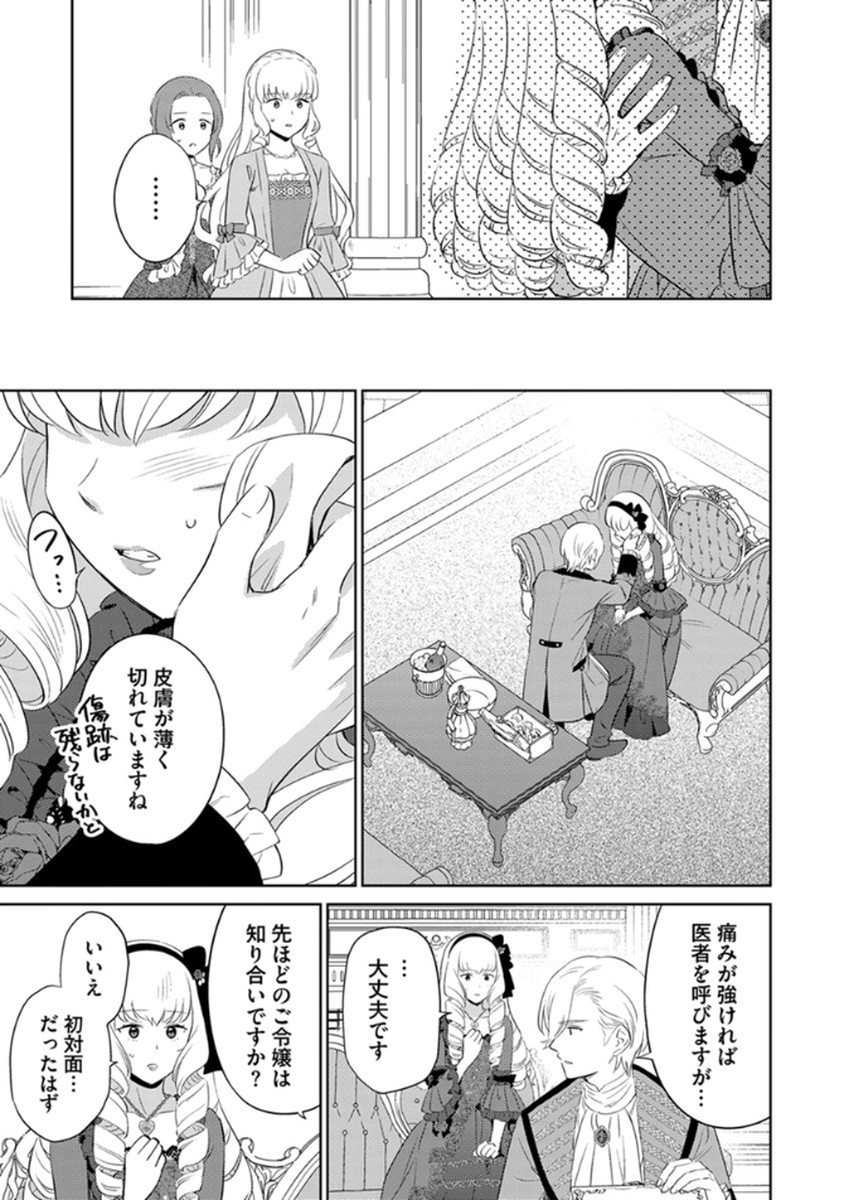 P17