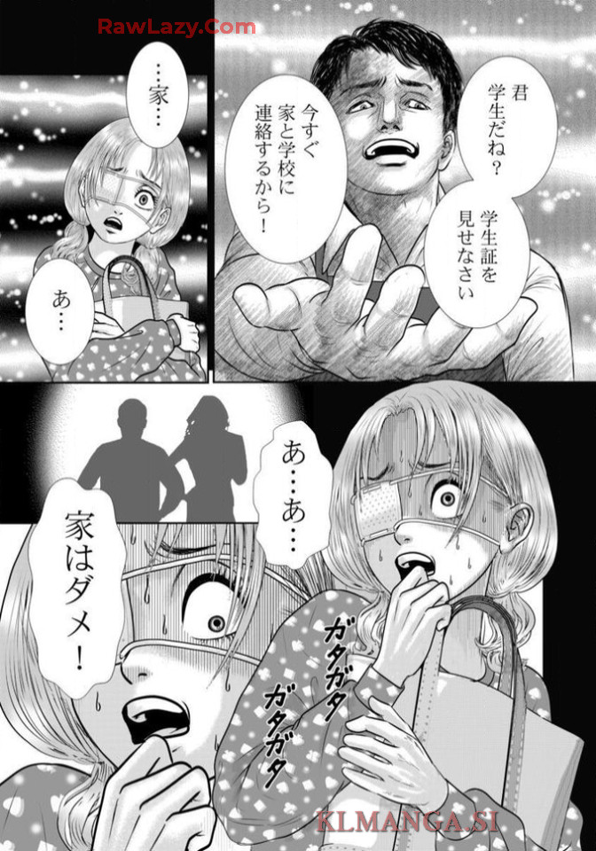 P29