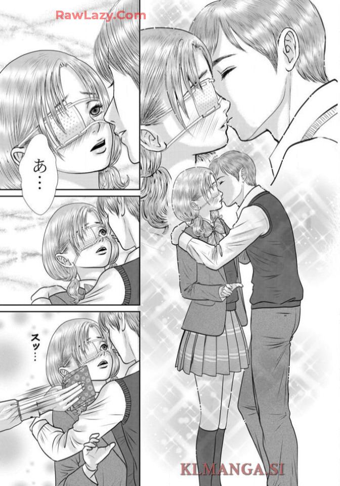 P25