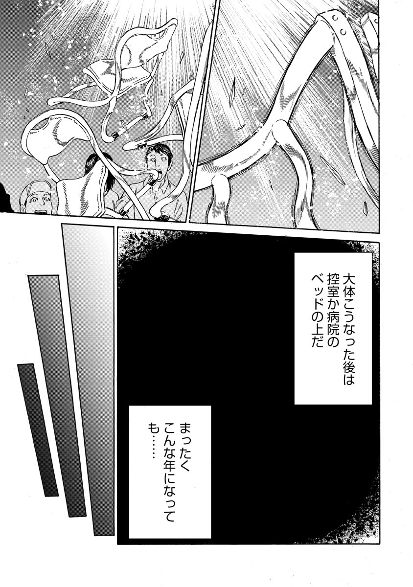 P11