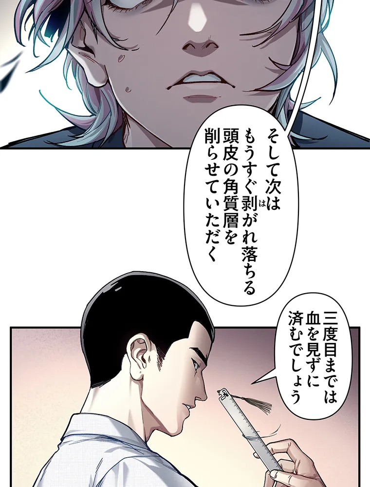 P35