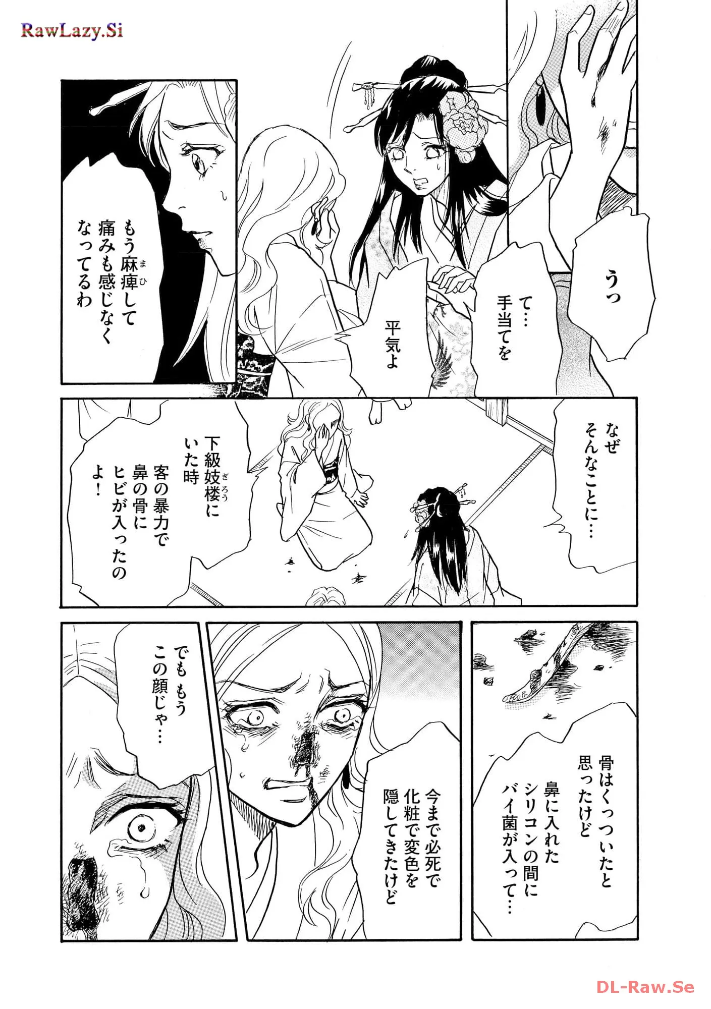 P28