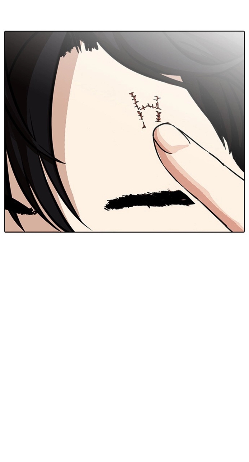 P99
