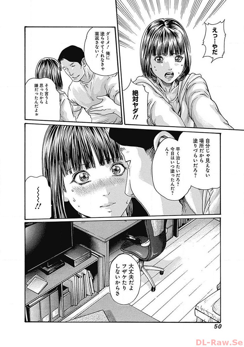 P14