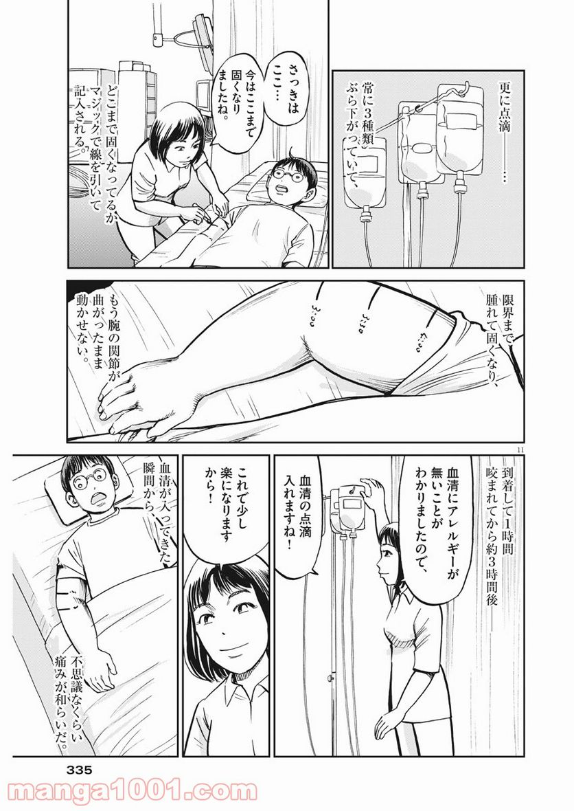 P11