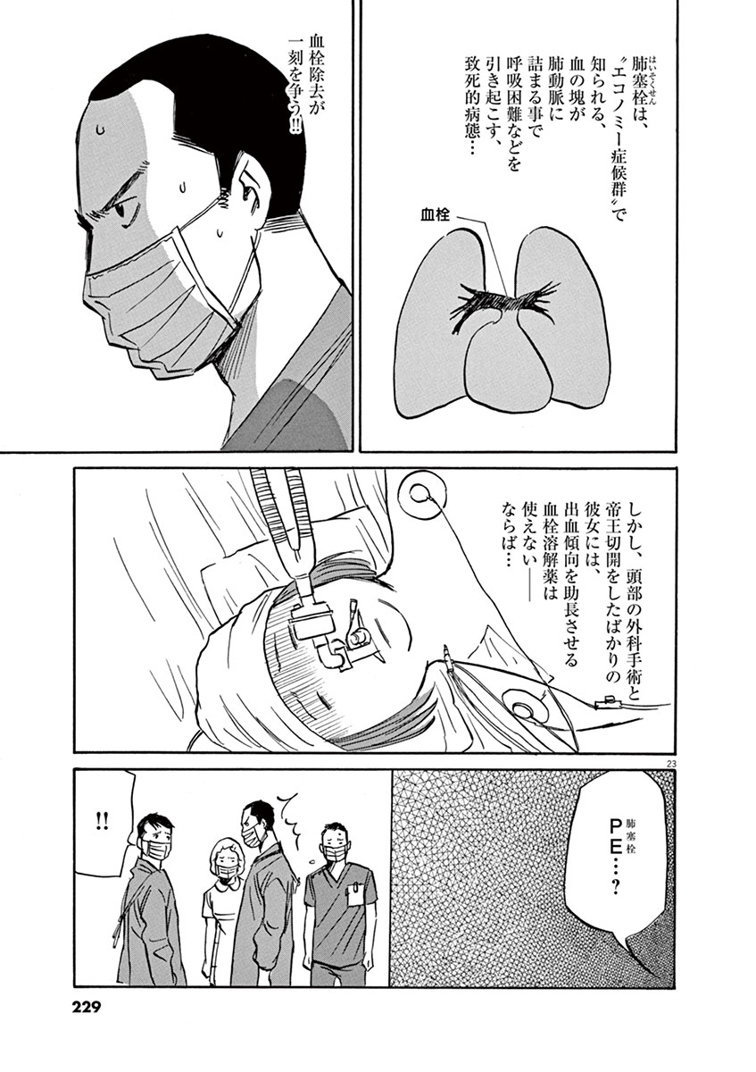 P23