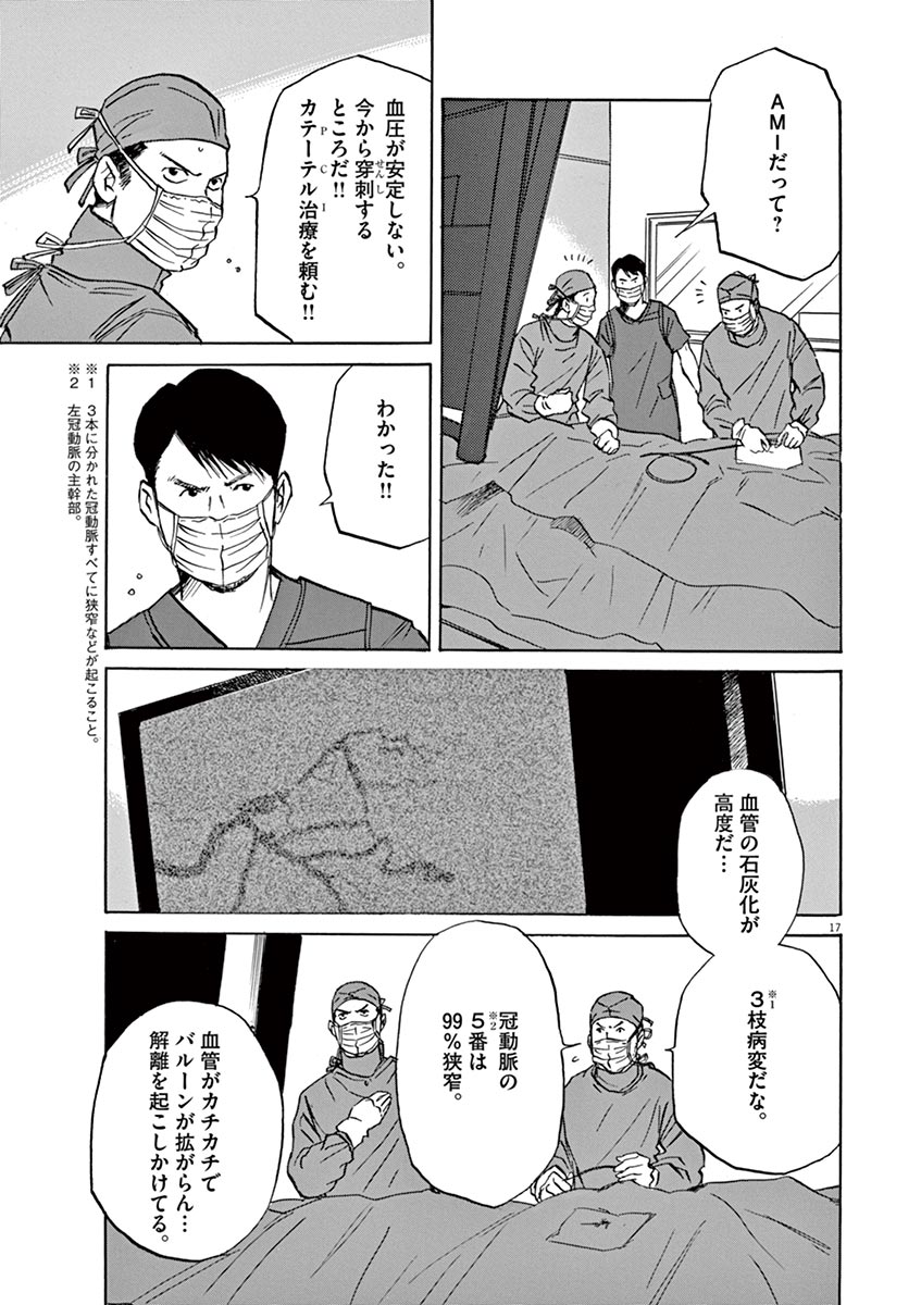 P17