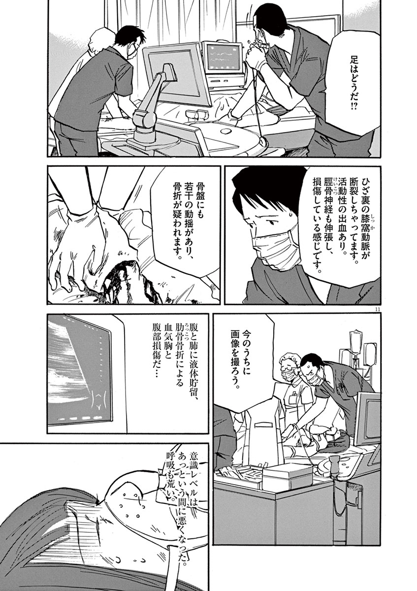 P11