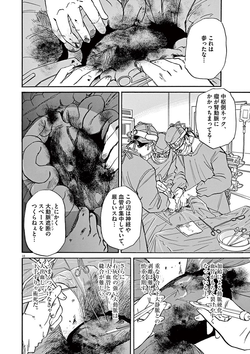 P18
