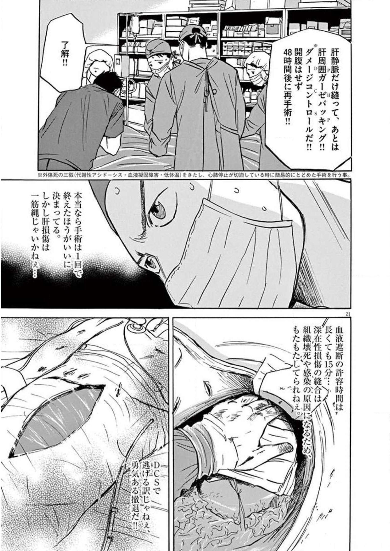 P21