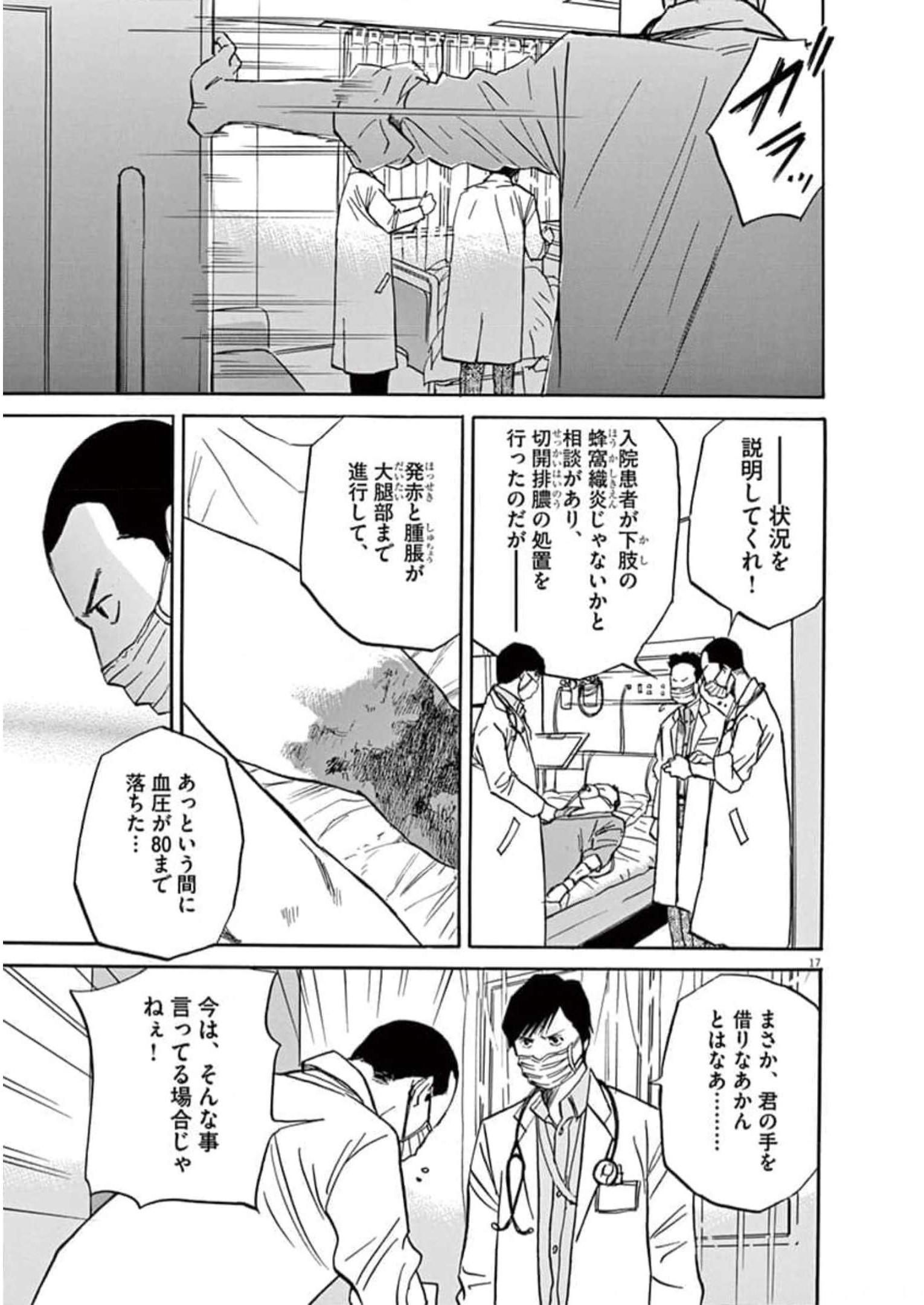 P17