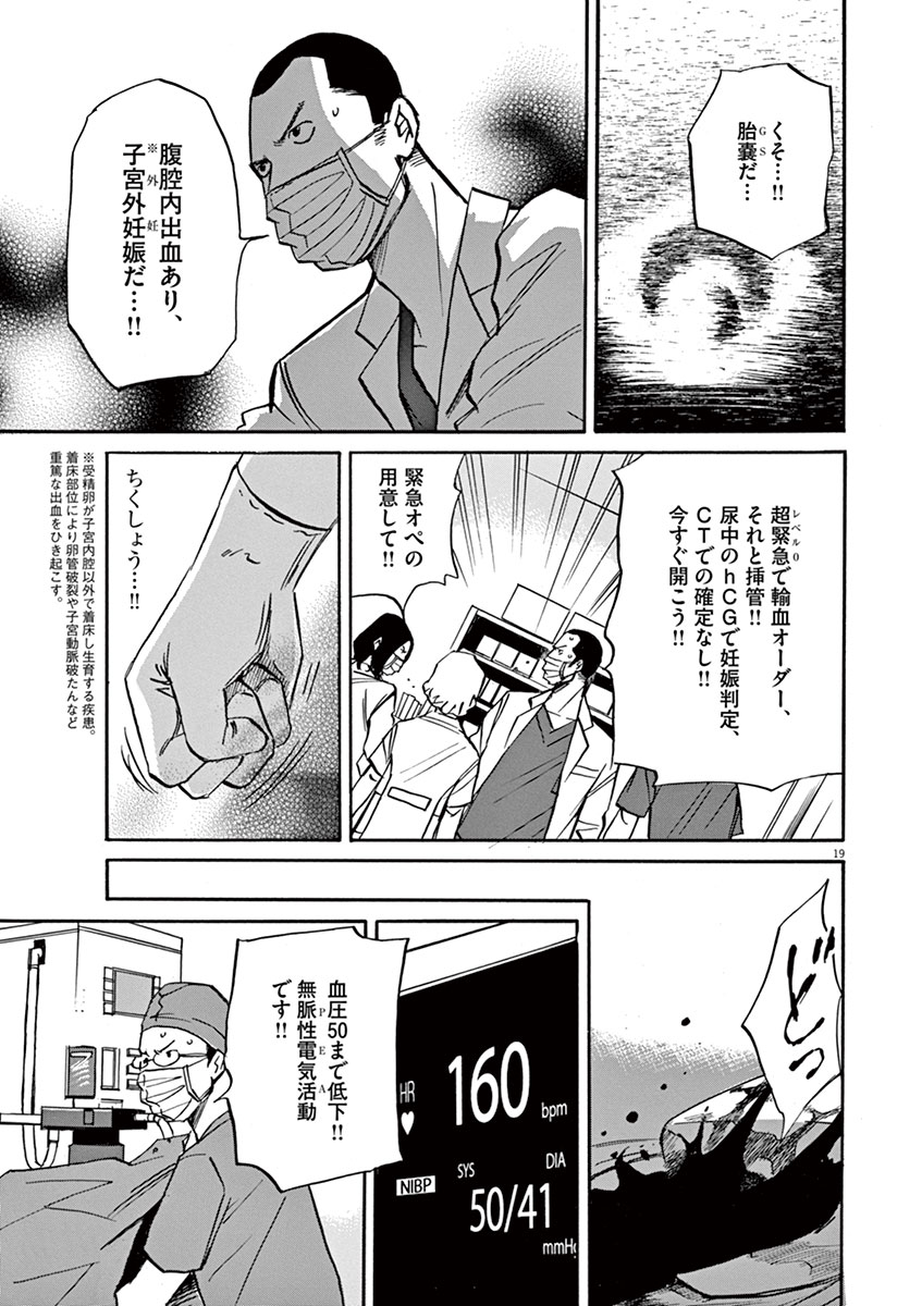 P19