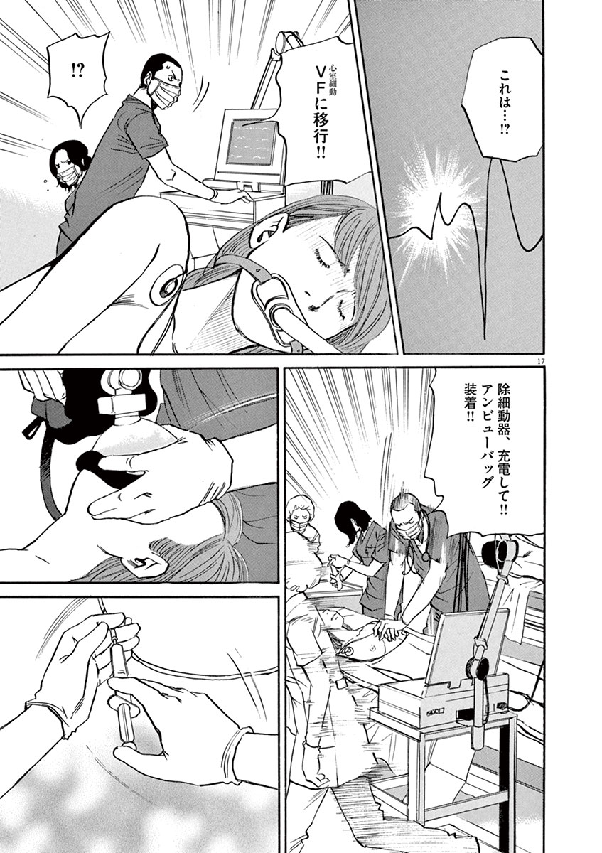 P17