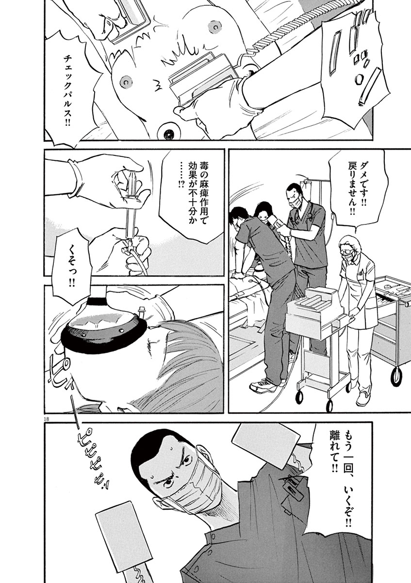 P18