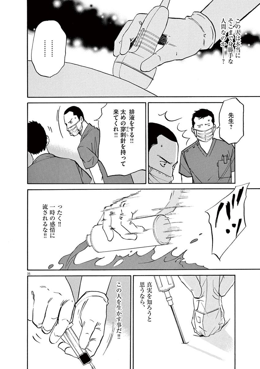 P35