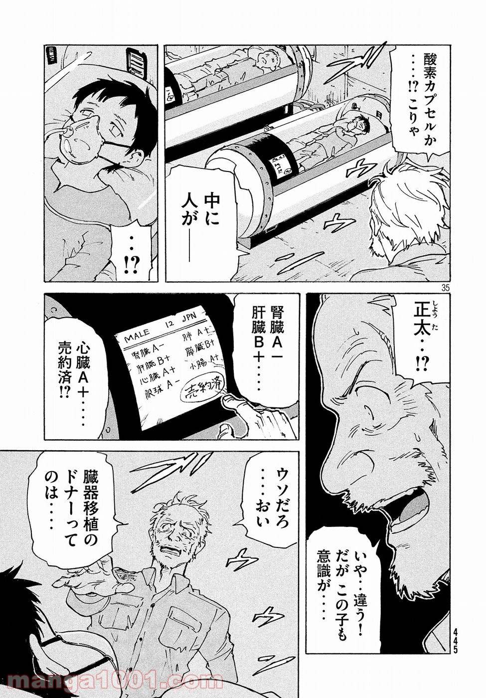 P35