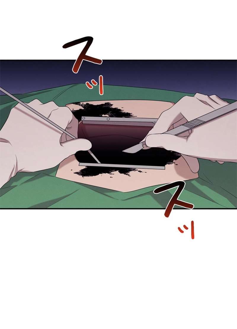 P76