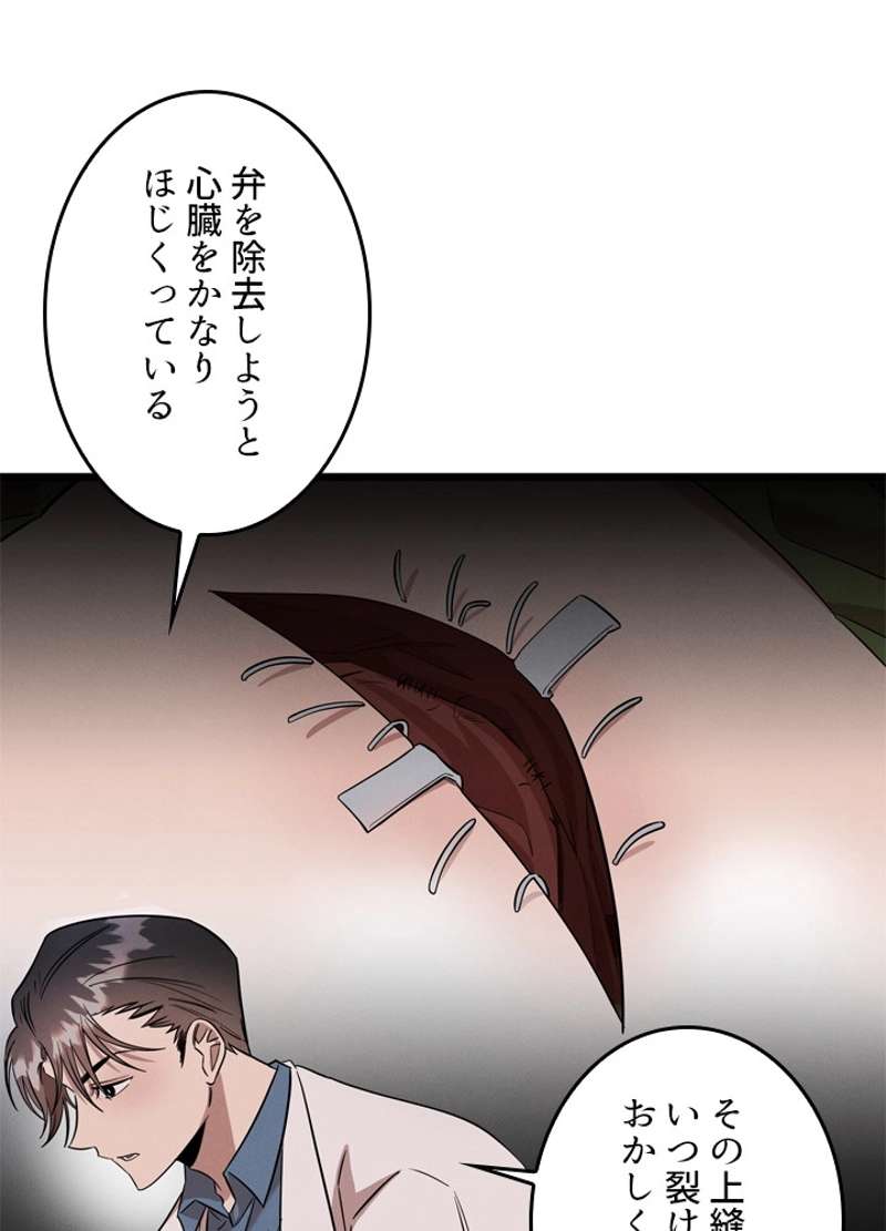 P57