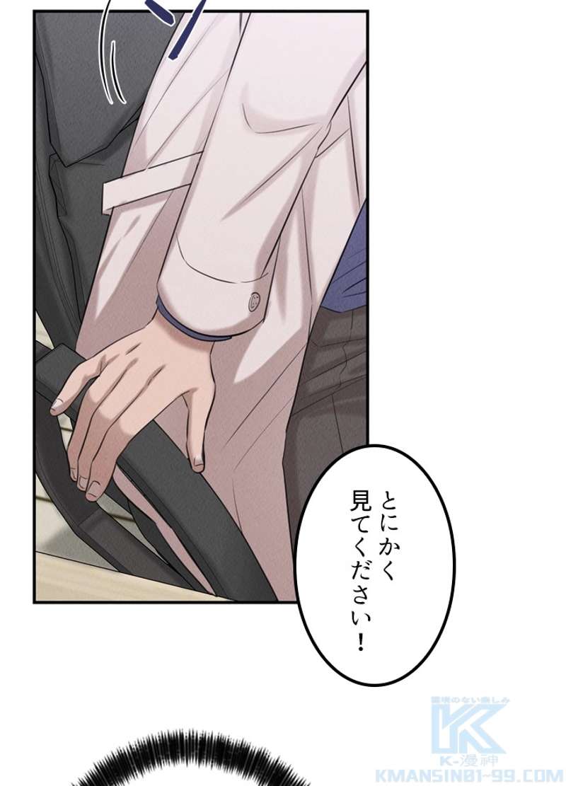 P35
