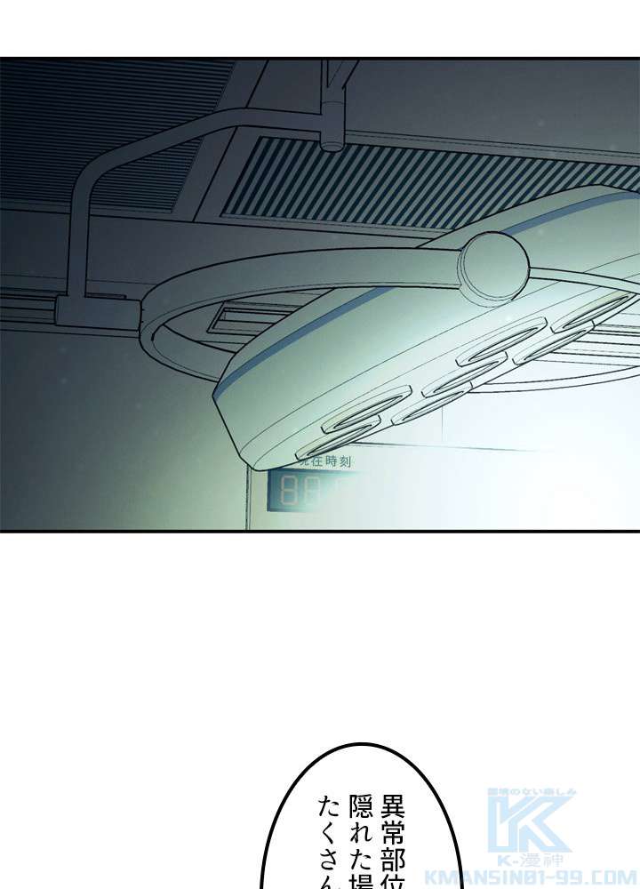 P85