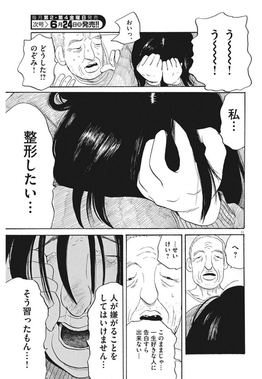 P11