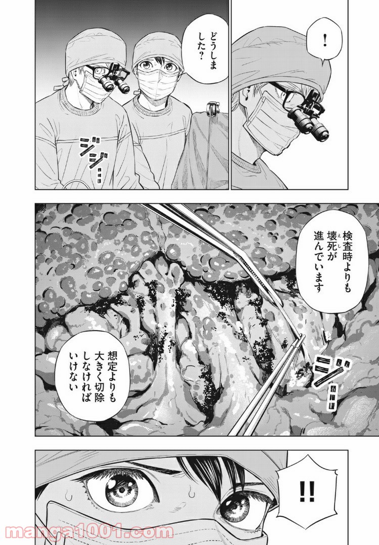 P14