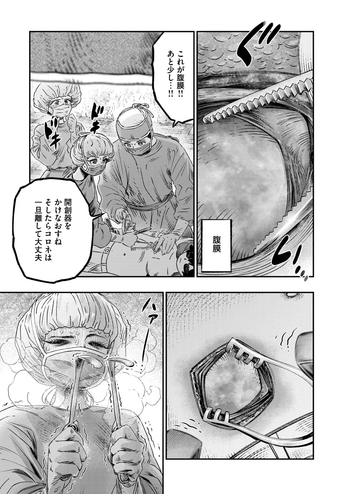P35