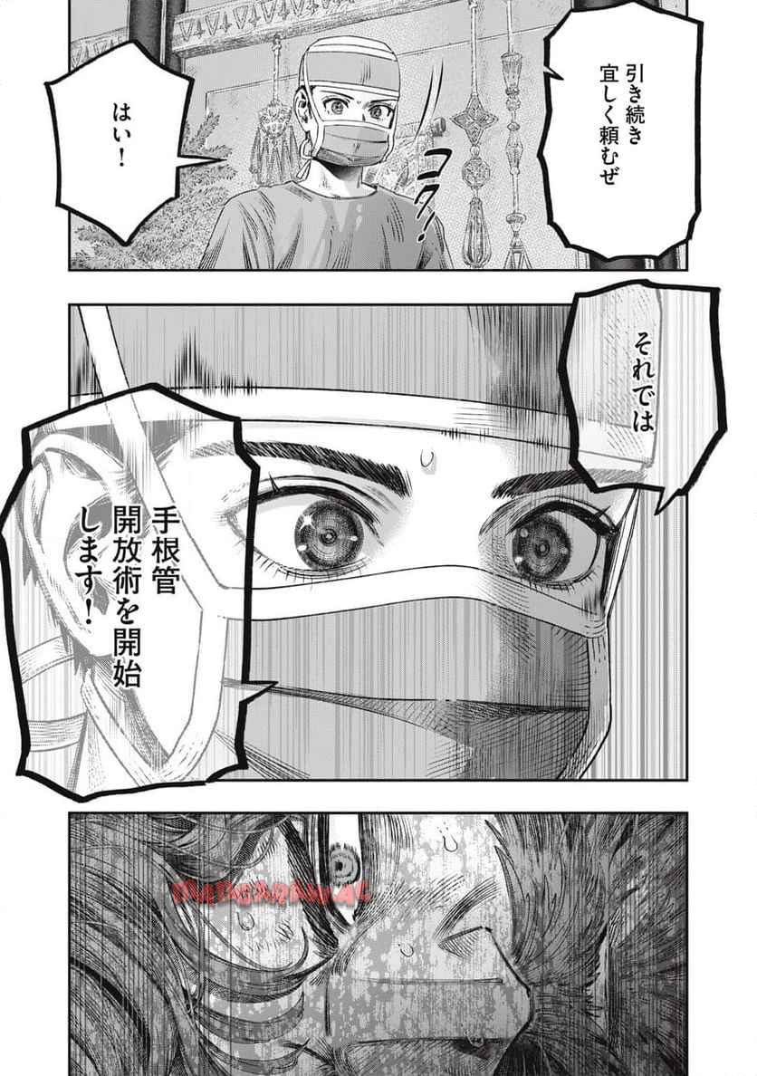 P21