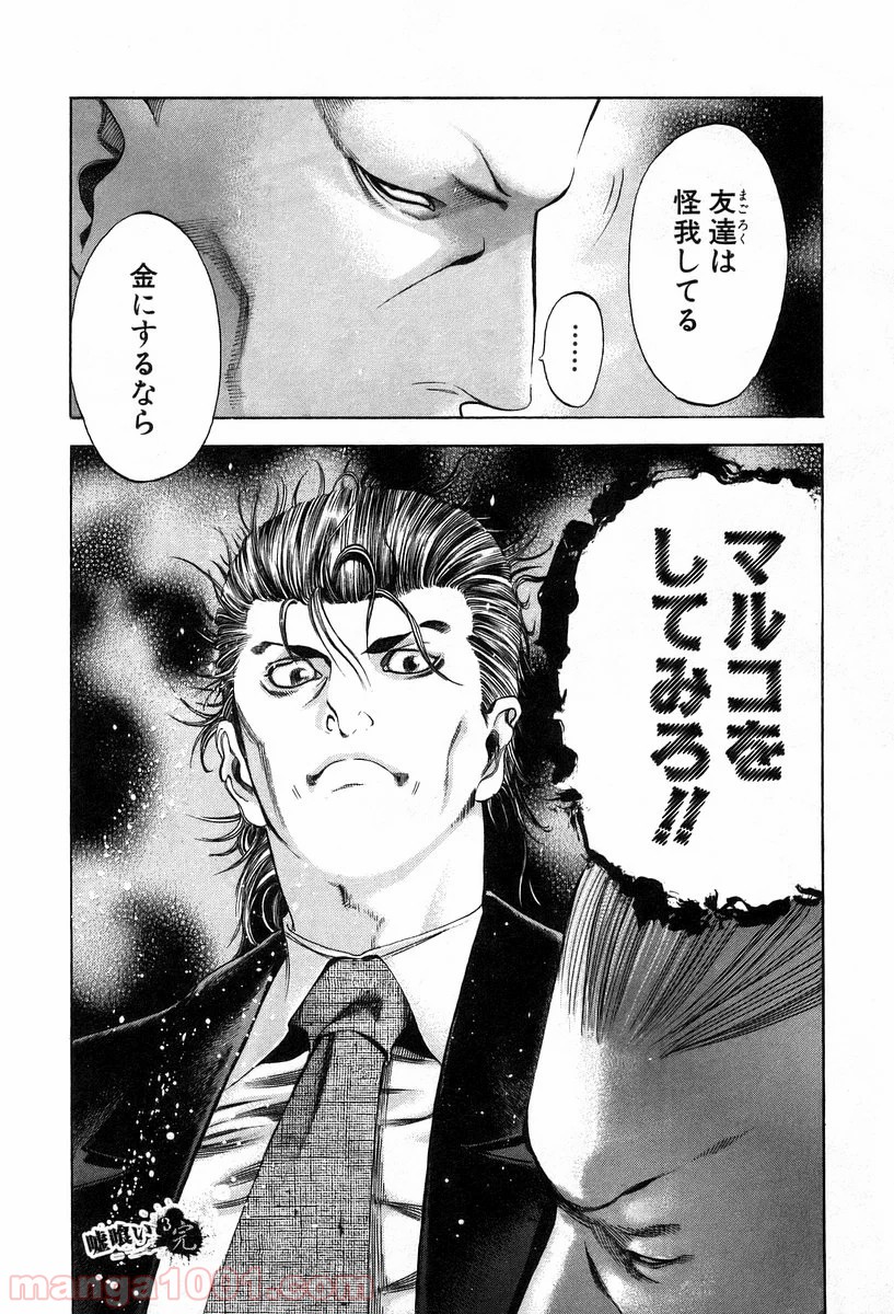 P20