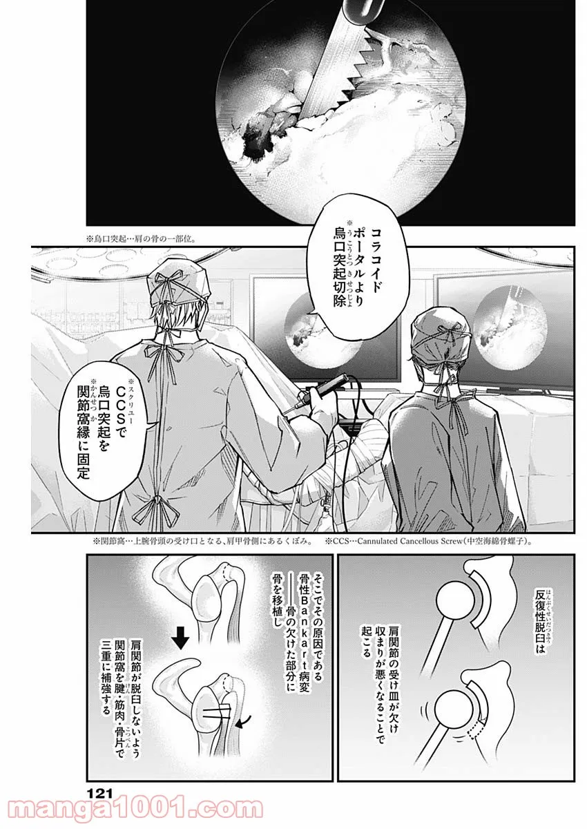 P17