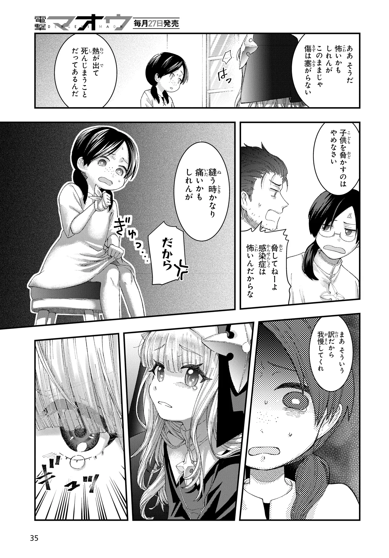 P35