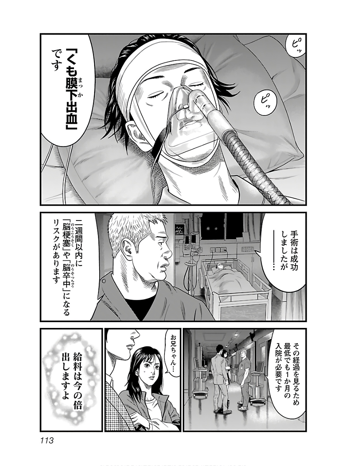 P113