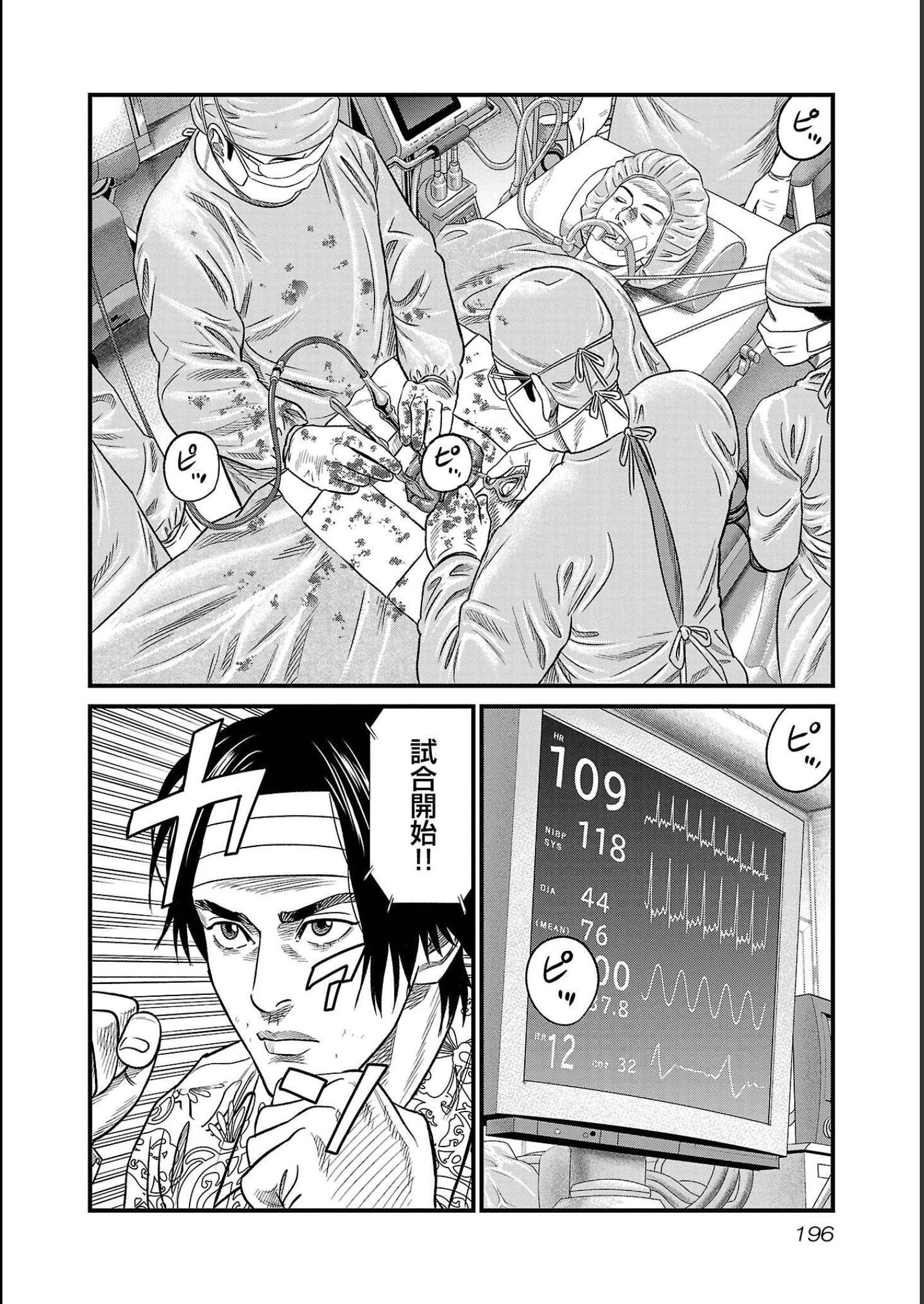 P193