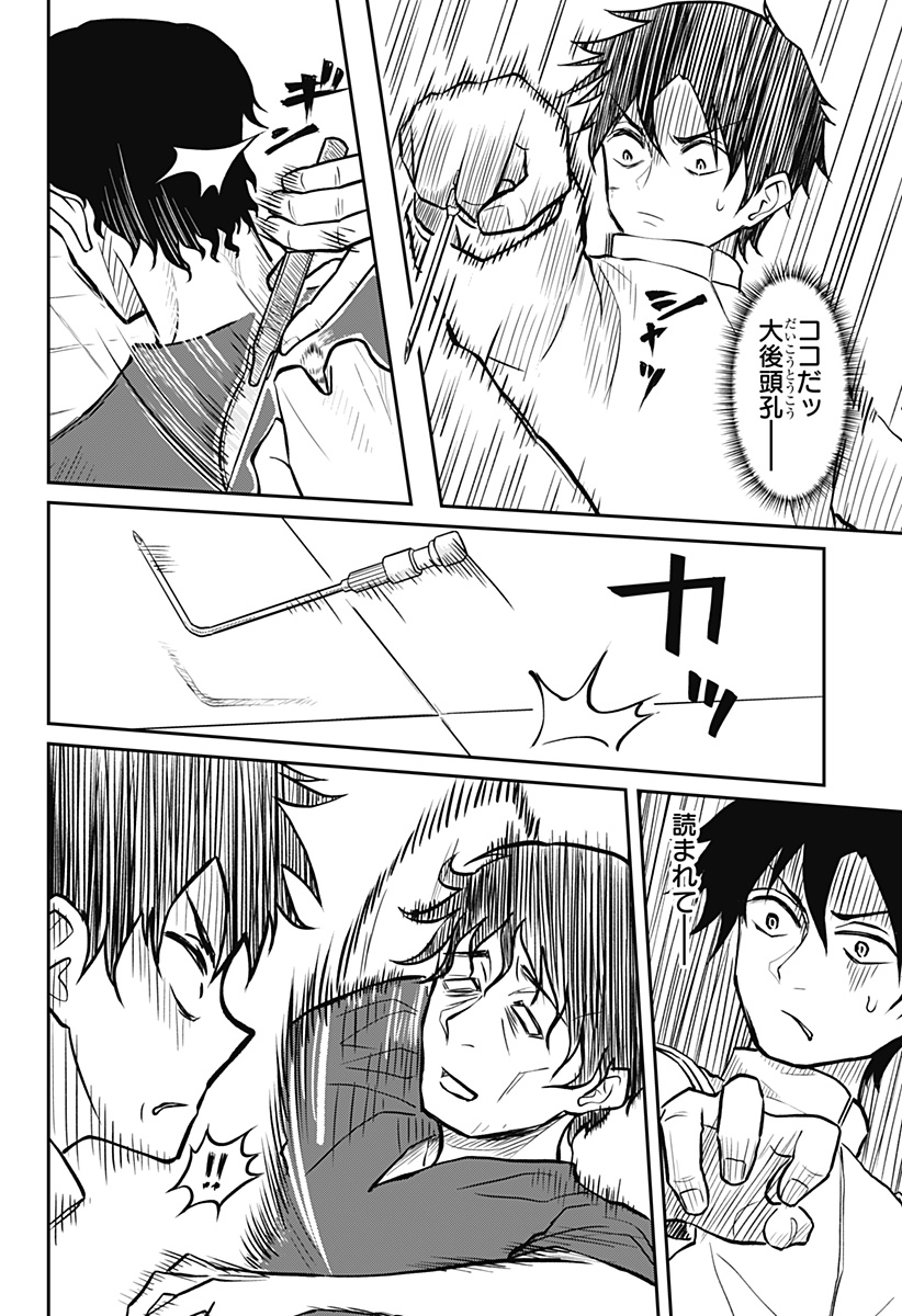 P28
